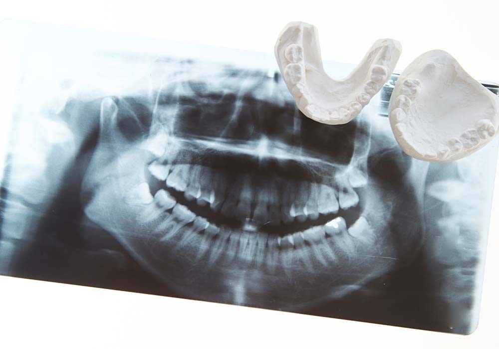 精密検査を行います