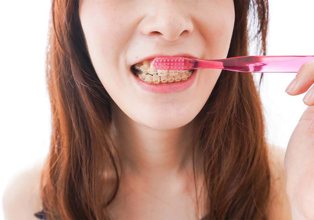 矯正治療の注意点