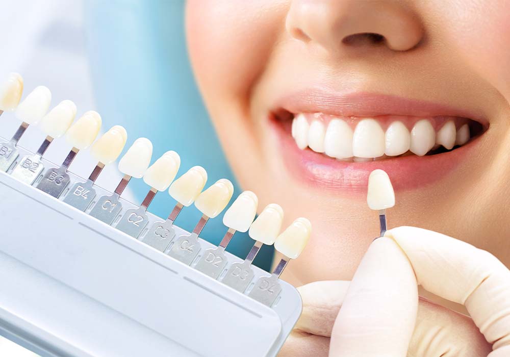 デュアルホワイトニング